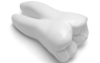 How to replace lost Teeth