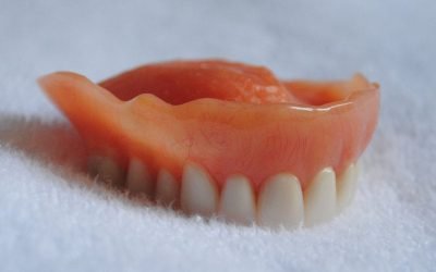7 Frequently Asked Questions About Dentures