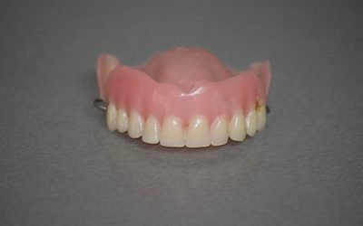 Different Types of Dentures