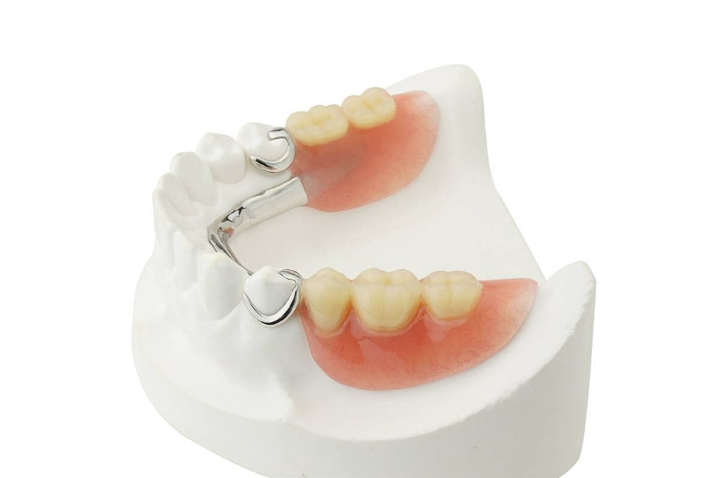  Denture Implants