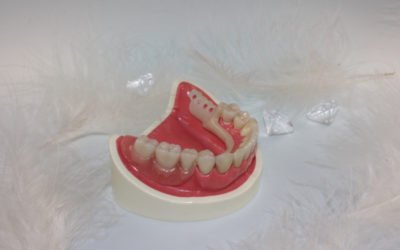 How To Relieve Irritation From Dentures